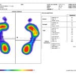 estatica_1_analisis_de_presion